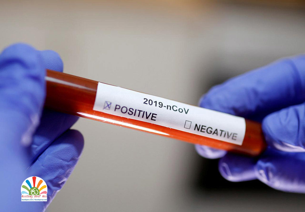 ಉಡುಪಿ ಜಿಲ್ಲೆ: ಶುಕ್ರವಾರ 15 ಪಾಸಿಟಿವ್. ಒಟ್ಟು 164ಕ್ಕೆ ಏರಿಕೆ