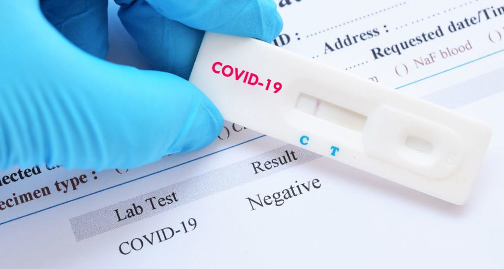 ಉಡುಪಿ ಕೊರೋನಾ ಅಪ್ಡೇಟ್: ಒಟ್ಟು 946 ಮಂದಿ ಡಿಸ್ಚಾರ್ಜ್. ಗುರುವಾರ ಪಾಸಿಟಿವ್ ಇಲ್ಲ