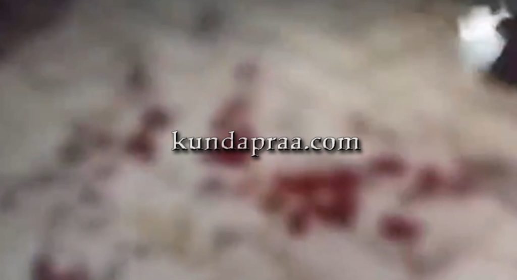 ಕುಂದಾಪುರ: ಹಳೆ ದ್ವೇಷಕ್ಕೆ ವ್ಯಕ್ತಿಯೋರ್ವನಿಗೆ ಚೂರಿ ಇರಿತ?